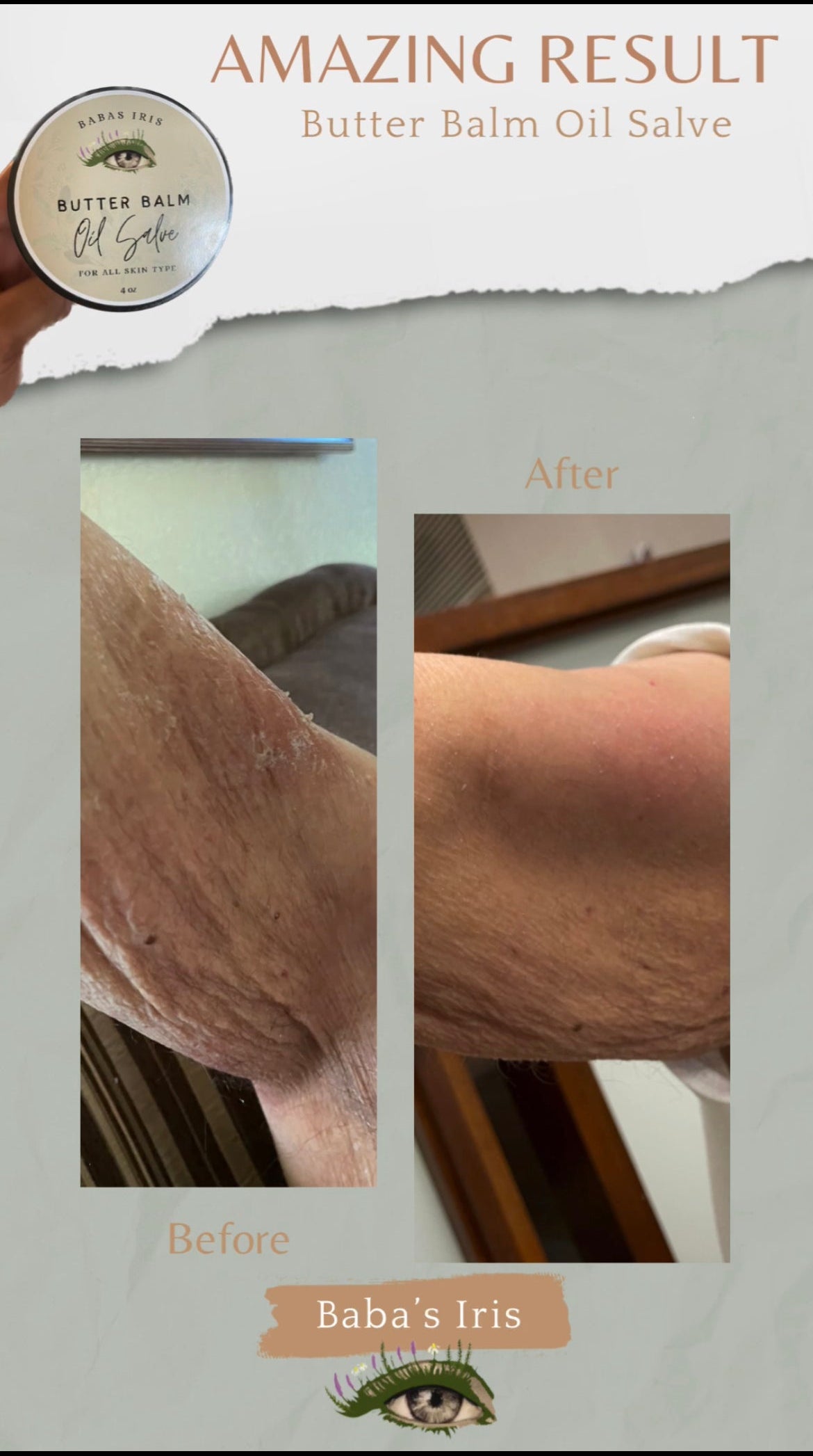 Butter Balm Oil Salve | Restorative Skin Renewal & Repair