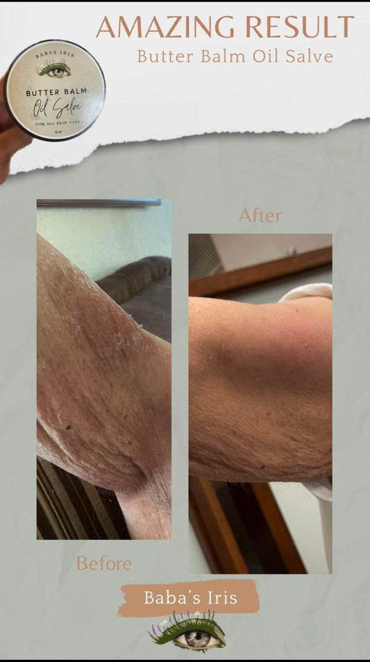 Butter Balm Oil Salve | Restorative Skin Renewal & Repair